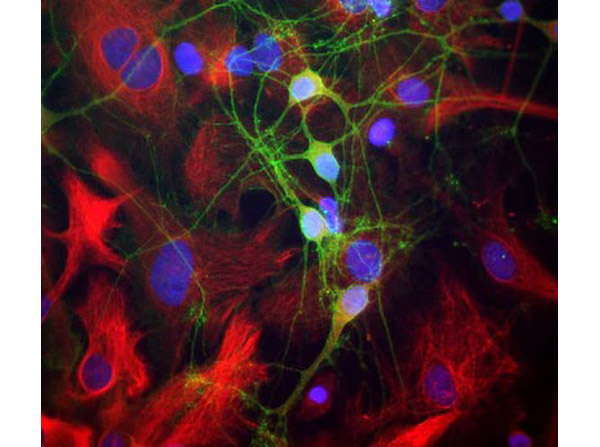 Immunofluorescence of anti-alpha-II-spectrin